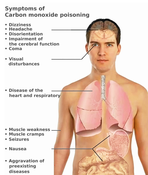 carbon monoxide poisoning symptoms at school